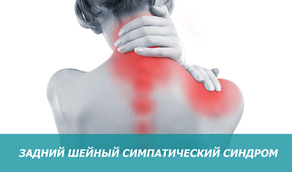Задній шийний симпатичний синдром (синдром хребетної артерії): симптоми та лікування, фото 1