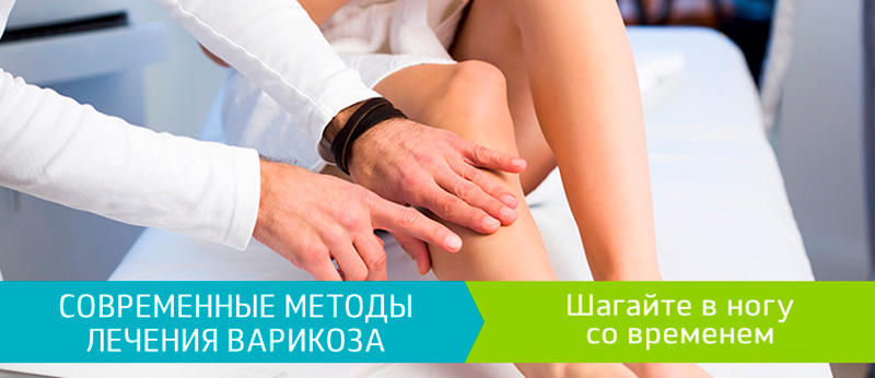 Сучасні методи лікування варикозу. Крокуйте в ногу з часом, фото 1